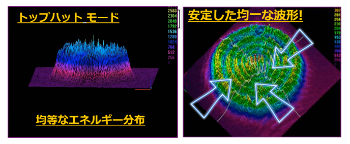 ルートロトーニングによる肝斑治療