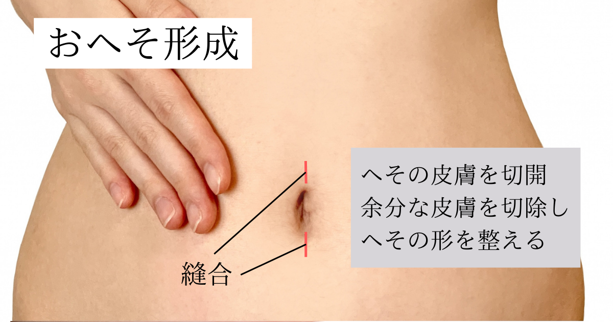 へその施術 新宿の美容外科 整形 しらゆりビューティークリニック