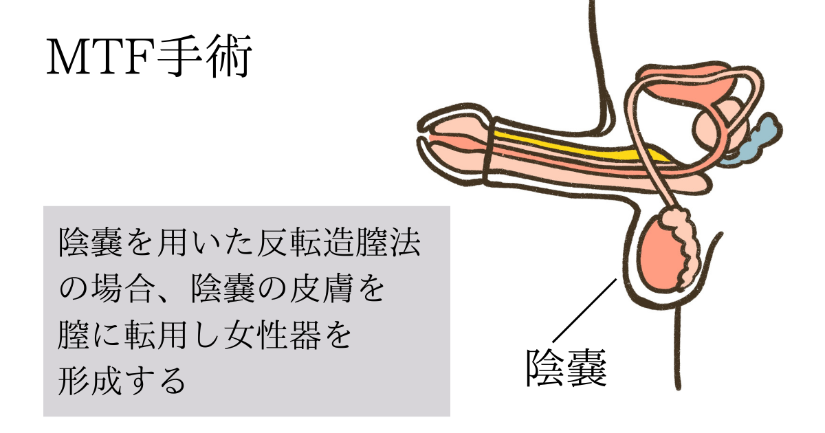 性転換手術　女性器 性転換 - 新宿の美容外科・整形｜しらゆりメディカルクリニック