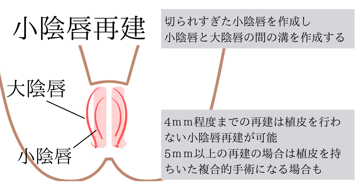 小陰唇再建